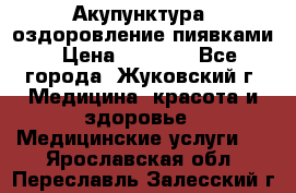 Акупунктура, оздоровление пиявками › Цена ­ 3 000 - Все города, Жуковский г. Медицина, красота и здоровье » Медицинские услуги   . Ярославская обл.,Переславль-Залесский г.